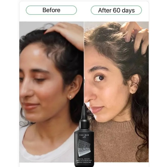 🤍2 for $75🤍 The Nue Co Supa Thick scalp treatment - Picture 2 of 6